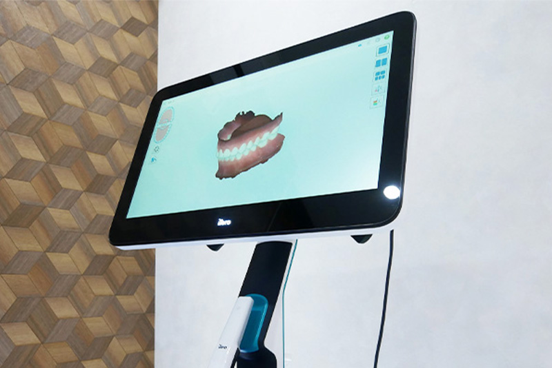 口腔内3Dスキャナー