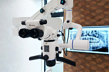 根管治療に精通した歯科医師が行う精密な治療